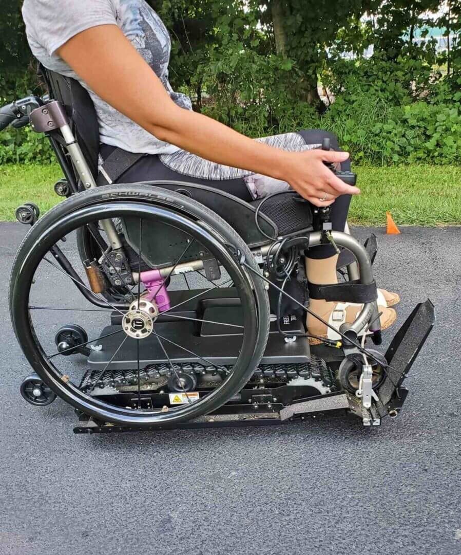 Individual in wheelchair with amputated leg